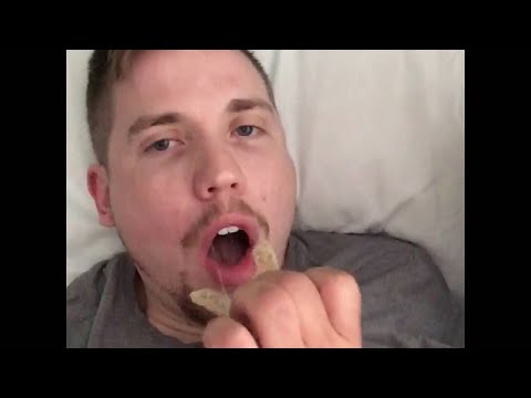 Man Leaves Retainer in for Five Years || ViralHog