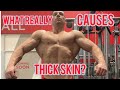 Bodybuilders and THICK SKIN?