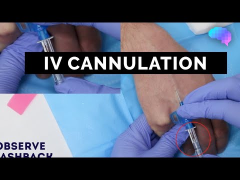 Intravenous (IV) cannulation | OSCE Guide | UKMLA | CPSA | PLAB 2