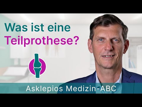 Teilknieprothese verstehen: Verfahren in Hamburg, Deutschland