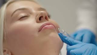 Lip Filler at Aestique Medispa