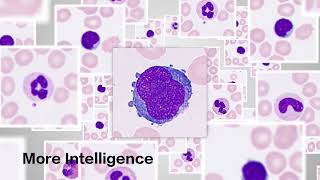 MC-80 Automated Digital Cell Morphology Analyzer