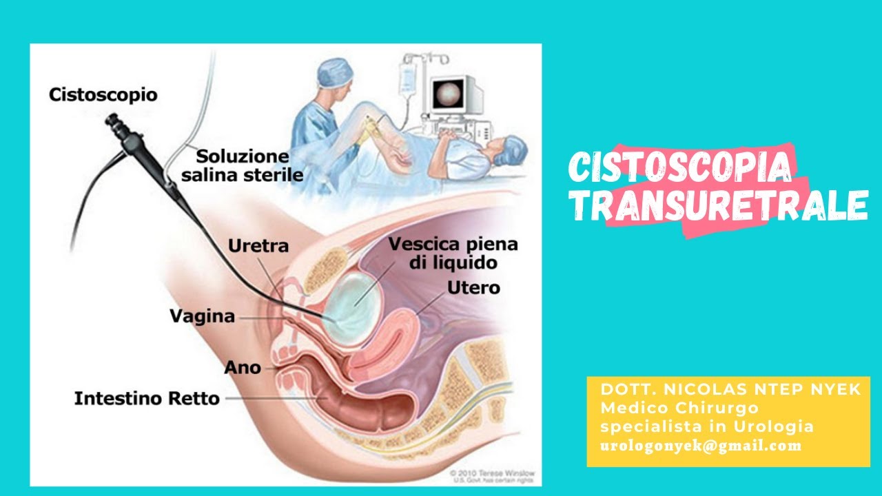 Nicolas Nyek Ntep-21