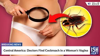 Central America: Doctors Find Cockroach in a Woman’s Vagina