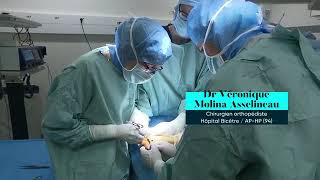 [Avec Allodocteurs] Névrome de Morton : opérer quand le pied fait mal