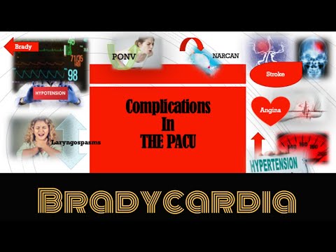 Bradycardia, Complication in PACU