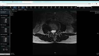 Download lagu ML-Columna2 mp3 Download lagu ML-Columna2 mp3