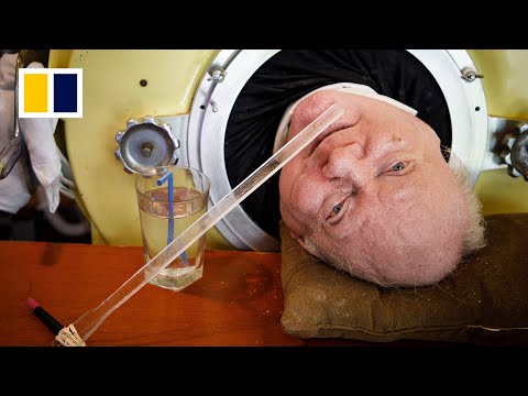 ‘Man in iron lung’ dies