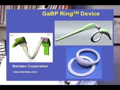 Banding the Pouch in the Gastric Bypass with the GaBP Ring™