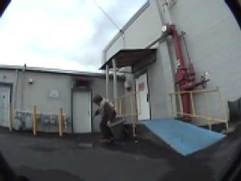 Sionide Montage- "Cheese Wedge"