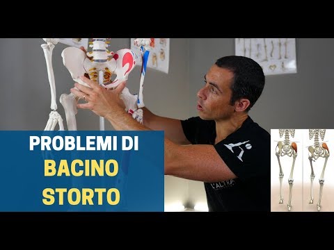 ASIMMETRIA, ROTAZIONE O DISMETRIA del BACINO: ecco cosa fare! (aggiornato 2019)