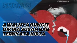 Viral Wanita Awalnya Dikira Perut Buncitnya karena Susah BAB, Syok saat Tahu Ada Kista 30 Cm