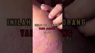 Download lagu Inilah akibat orang yang jarang mandi #shortvideo mengingatkan mp3 Download lagu Inilah akibat orang yang jarang mandi #shortvideo mengingatkan mp3