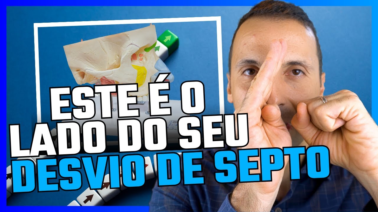 ESSE É O LADO DO SEU DESVIO DE SEPTO E VOU TE PROVAR