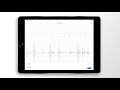 Atrial Fibrillation Combined Heart Sound, PCG & ECG Example - EkoCLINIC App