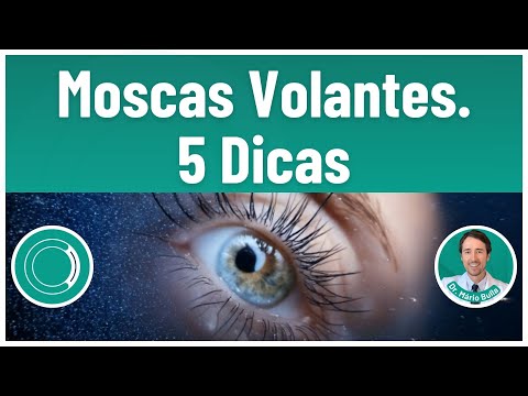 Floaters: 5 Treatment Tips