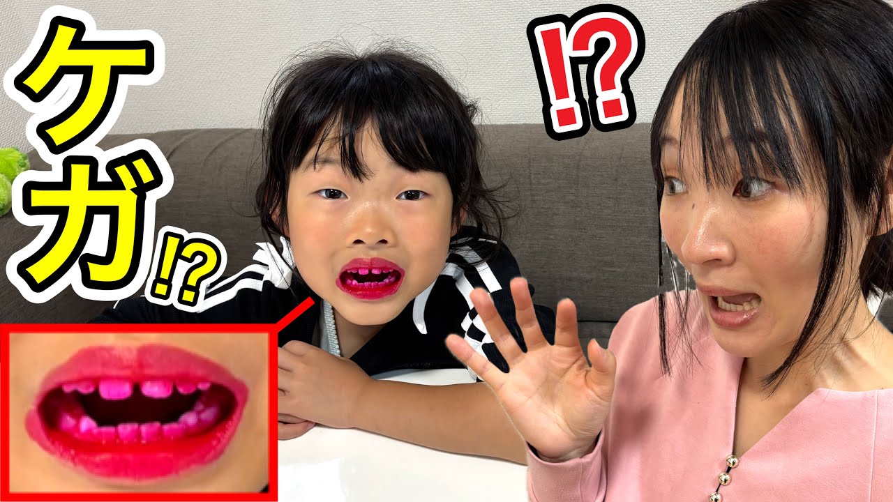 口ケガしたの⁉️病院行く⁉️口が真っ赤なここちゃんにママが近寄ったら・・・・・・・・😳💦【寸劇】