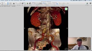 Angulação do Arco em C
