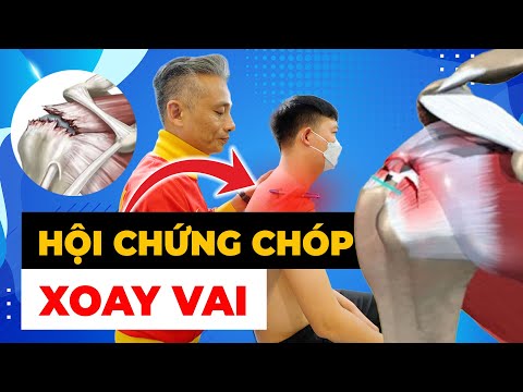 ĐAU VAI DỮ DỘI: Bí Mật Hội Chứng Chóp Xoay Mà BÁC SĨ KHÔNG NÓI VỚI BẠN!