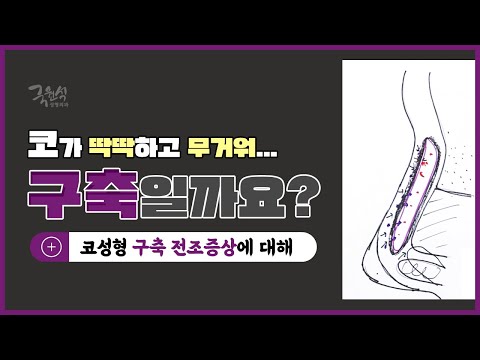 코성형 후 코가 딱딱하고 무거운데, #구축코 전조증상일까요?