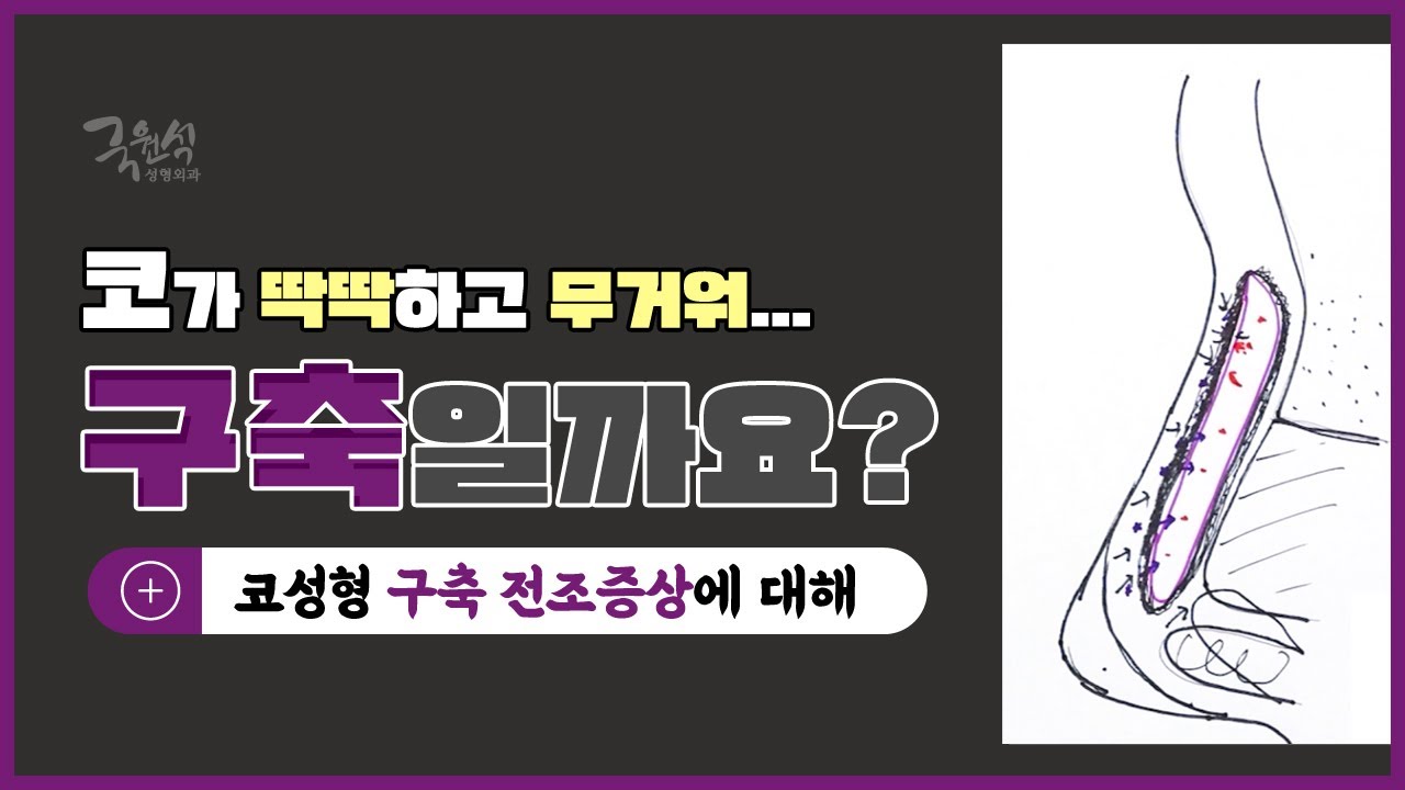 코성형 후 코가 딱딱하고 무거운데, #구축코 전조증상일까요? 썸네일