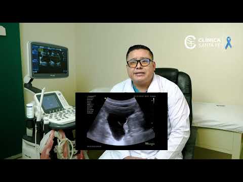 Clinica Santa Fe matagalpa,  estamos ubicados de los semáforos salomón Lopez 2c y media al este. 
