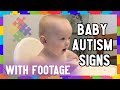 VERY EARLY AUTISM SIGNS IN BABY 0 12 Months Old Aussie Autism Family