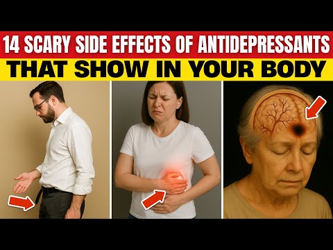 14 Serious Side Effects of Antidepressants That Show Up in Your Body | Evergreen Health