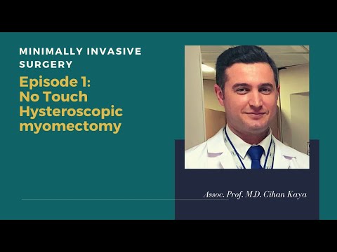 Hysteroscopic Myomectomy