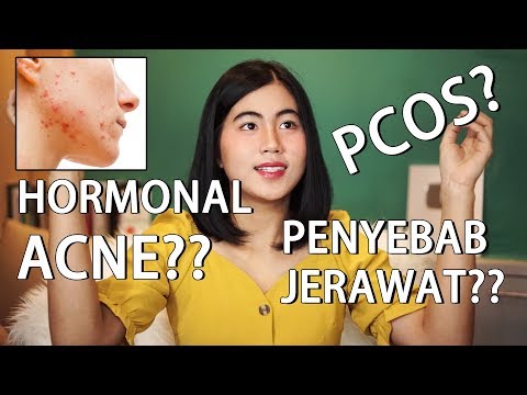 download lagu mp3 mp4 Cara Menghilangkan Jerawat Hormon Secara Alami, download lagu Cara Menghilangkan Jerawat Hormon Secara Alami gratis, unduh video klip Cara Menghilangkan Jerawat Hormon Secara Alami