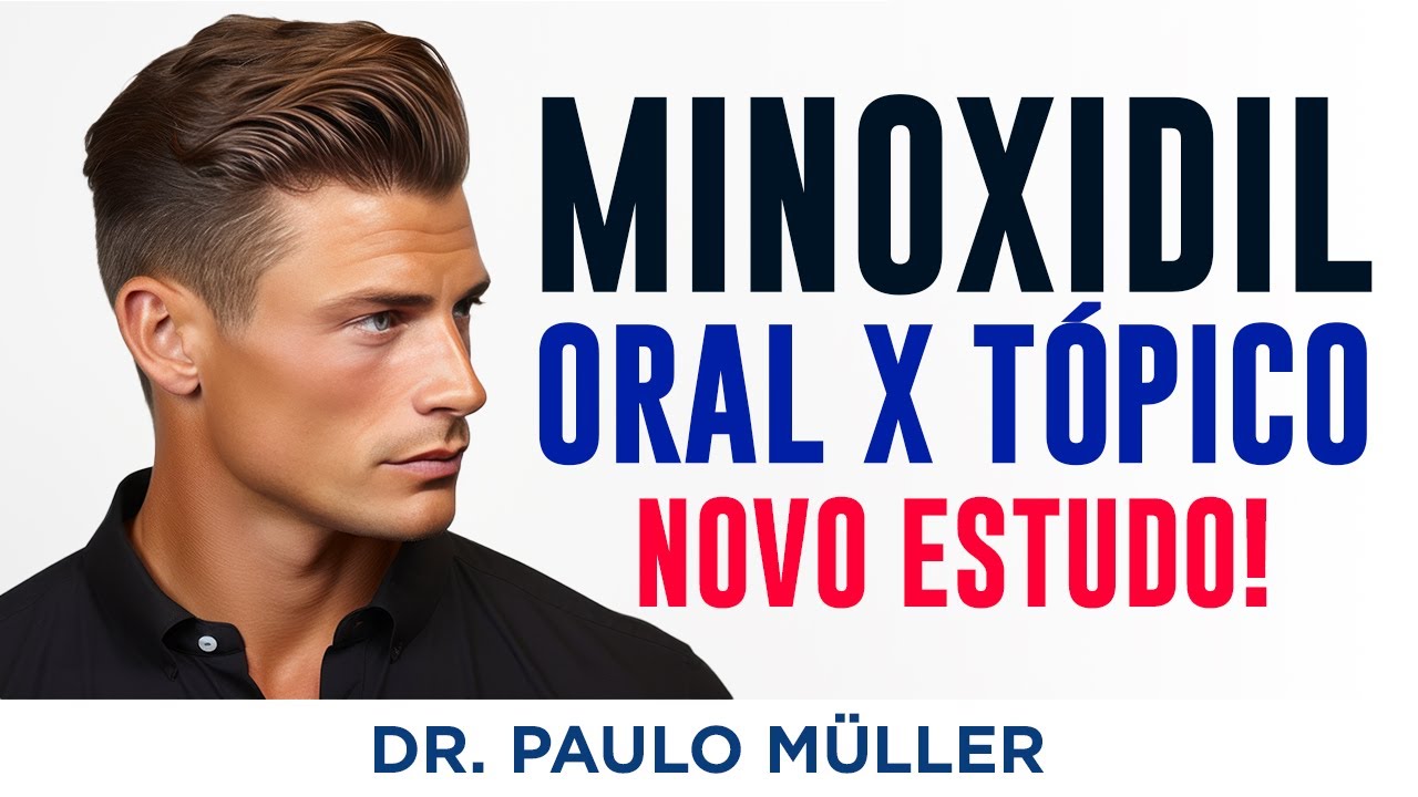 Minoxidil Oral x Minoxidil Tópico – Novo Estudo - *Não usar sem orientação Médica – Dr. Paulo Müller