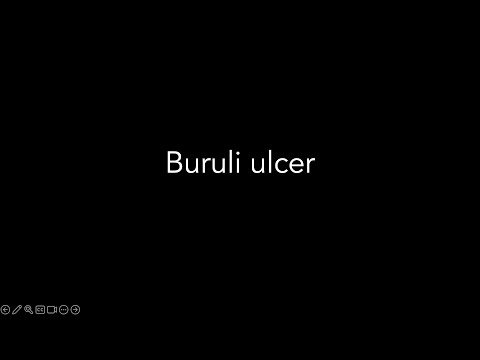 Lecture 23.3 - Abridged bacteria and viruses - Buruli ulcer