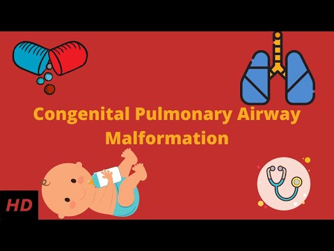 Hydrocephalus Causes Signs and Symptoms Diagnosis and Treatment