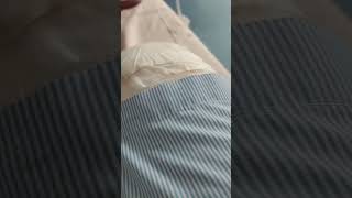 My Diabetic foot has been amputated last eventing by By Dr Deshmukh at Benz Hospital Santacruz