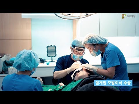 여성 헤어라인 수술과정 영상