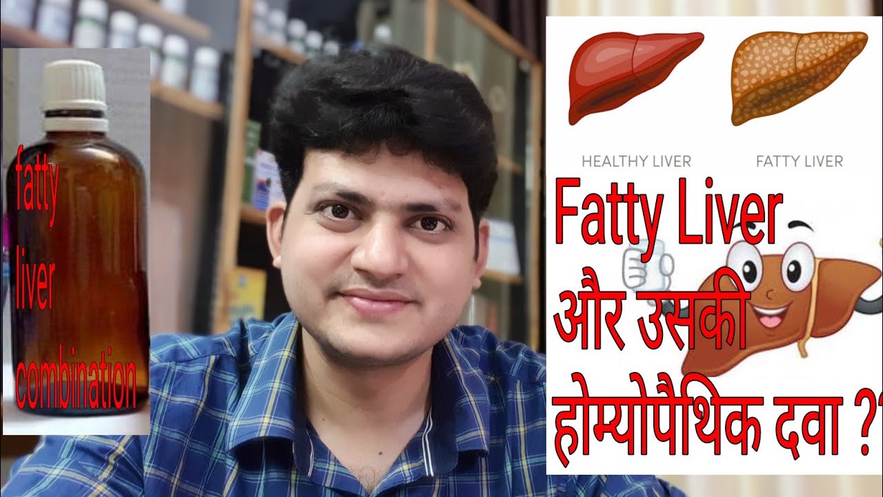 Fatty liver ! Homeopathic Medicine for Fatty liver ? My Combination !!