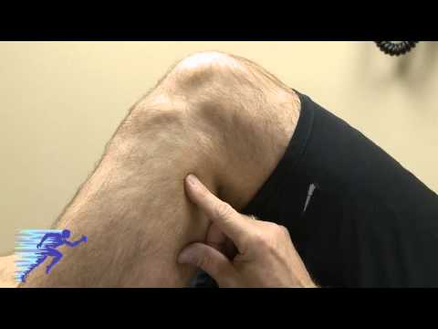 Peroneal Nerve Injury | Nerve Palpitations Causes | Knee Exam Maneuvers | Minneapolis St Paul, MN