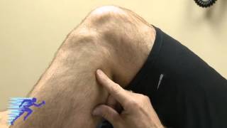 Peroneal Nerve Injury | Nerve Palpitations Causes | Knee Exam Maneuvers | Minneapolis St Paul, MN