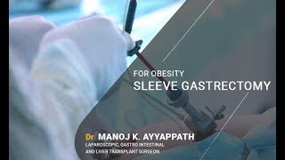 Laparoscopic Sleeve Gastrectomy for Obesity