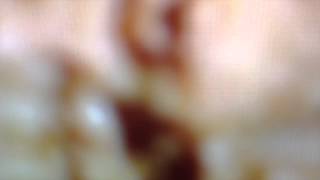 PANTHERA KRAUSE – CONDENSED MATTER