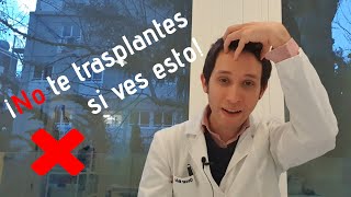 5 ADVERTENCIAS antes de elegir una CLÍNICA DE TRASPLANTE [2021]