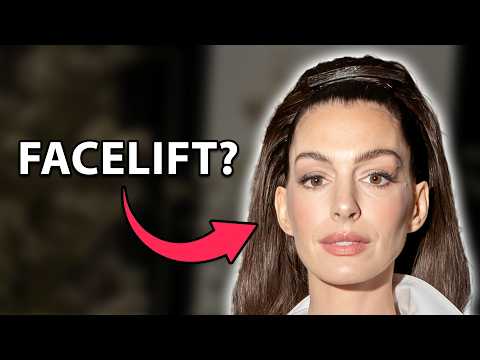 Truth Behind Anne Hathaway's Look *UPDATED 2026 INFO* | Plastic Surgery Analysis