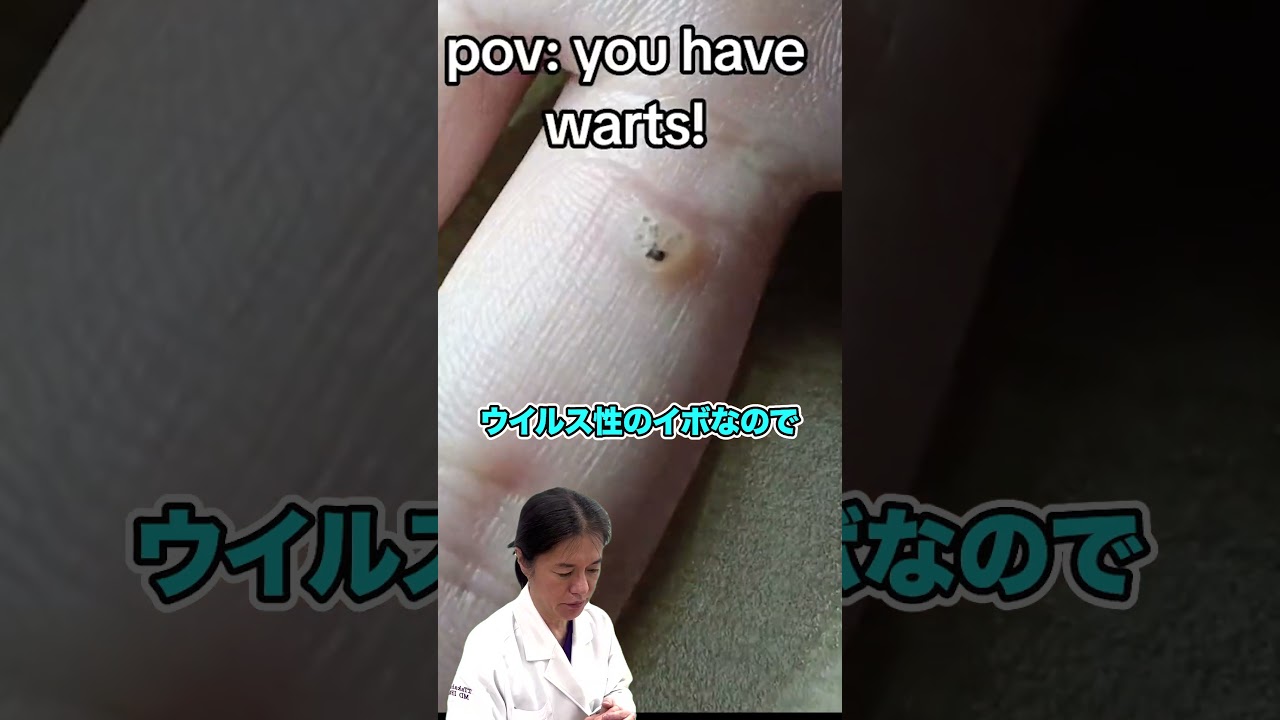 【ダーモスコピーで診断】皮膚科医の必需品！肉眼では判断が難しくても正確な治療が行えます！