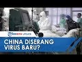 China Kembali Diserang Virus Baru, Ilmuwan Klaim Gejala G4 Lebih Serius Dibanding Virus Flu Lainnya China Kembali Diserang Virus Baru, Ilmuwan Klaim Gejala G4 Lebih Serius Dibanding Virus Flu Lainnya