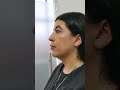 Rejuvenecimiento facial sin cirugía - Dra Lina Franco  #belleza