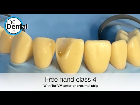 Class IV Freehand Using Tor VM Anterior Proximal Strips