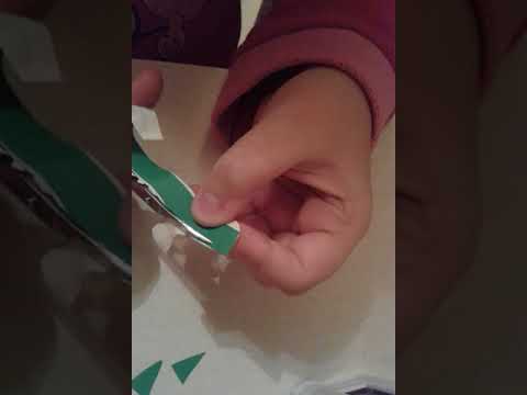 Come togliere posti di pigmentary con la persona a gravidanza La faccia di decolorazione fa i bagagli con miele