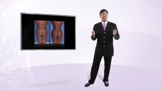 Increasing your butt size through fat transfer.