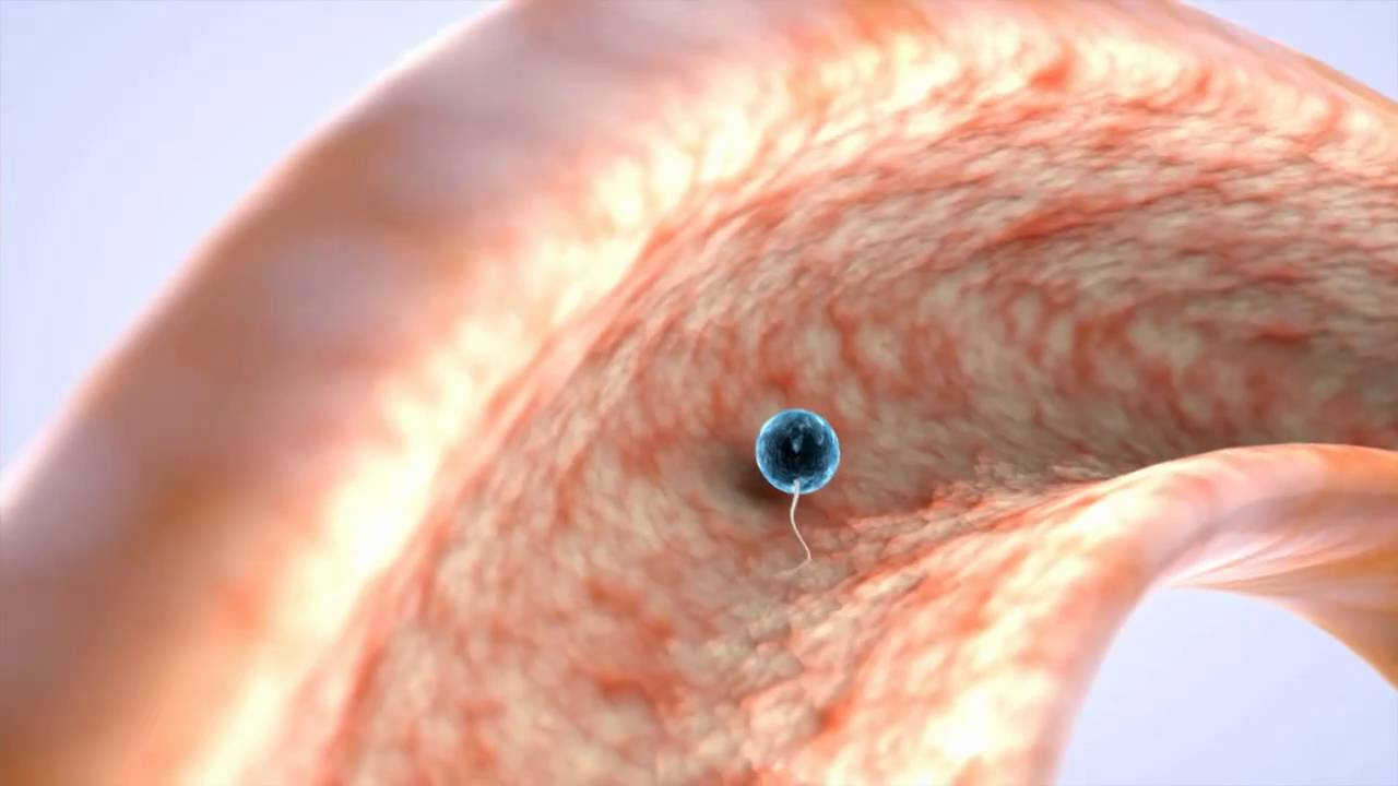 Miguel Angel Bedoya Osorio-3