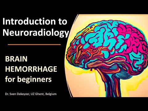 Imaging of Spontaneous Brain Hemorrhage: the basics!